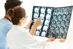 Medical providers reviewing brain scans